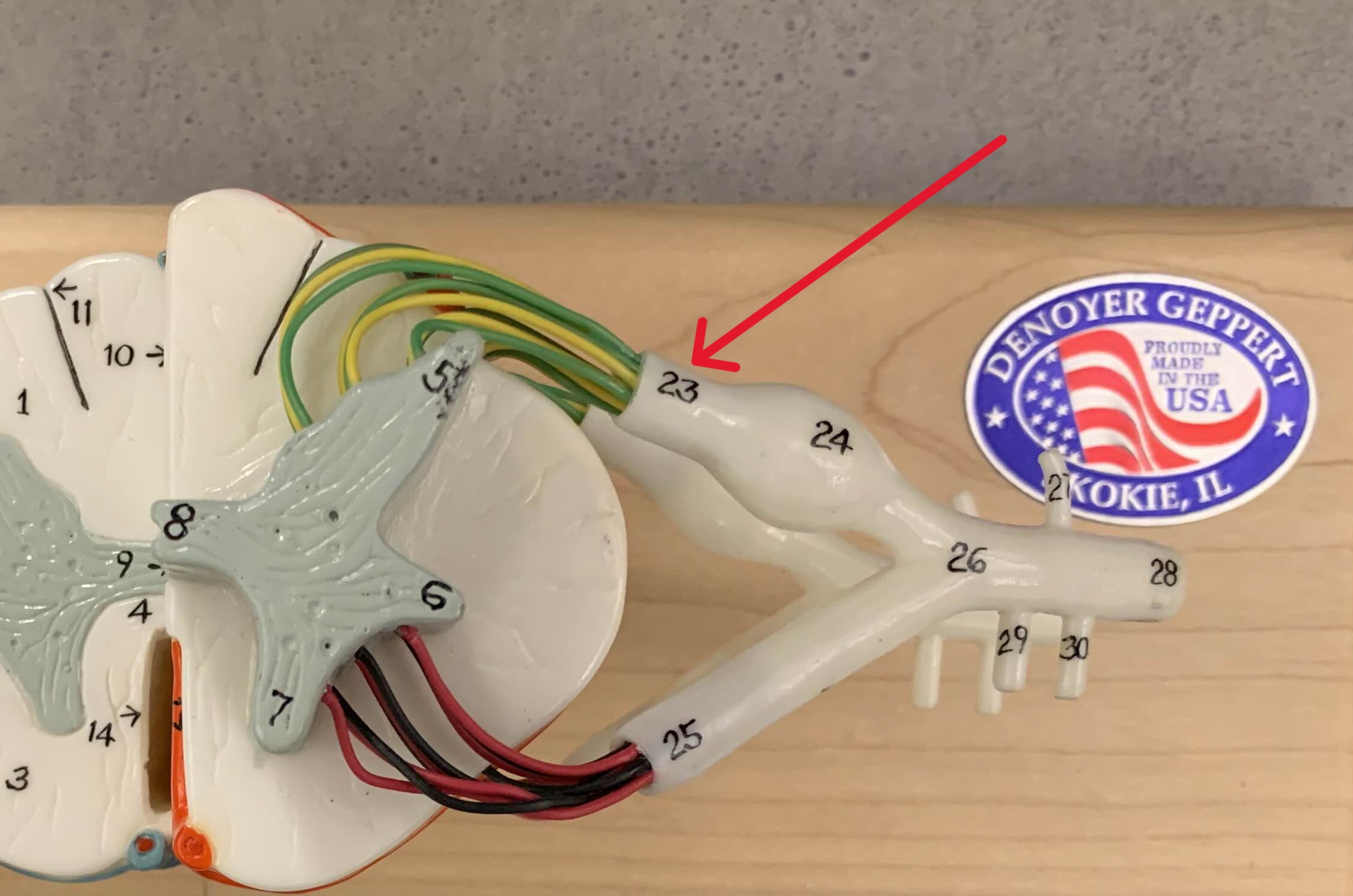 <p>Which part of the spiral cord is:</p><ul><li><p>Located on dorsal/posterior side</p></li><li><p>Look like roots</p></li><li><p>Contains axons of sensory neurons</p></li></ul><p></p>