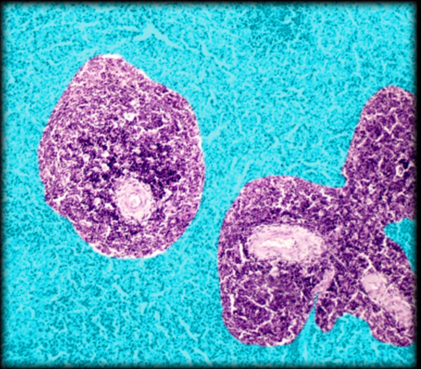 <p>Spleen</p>