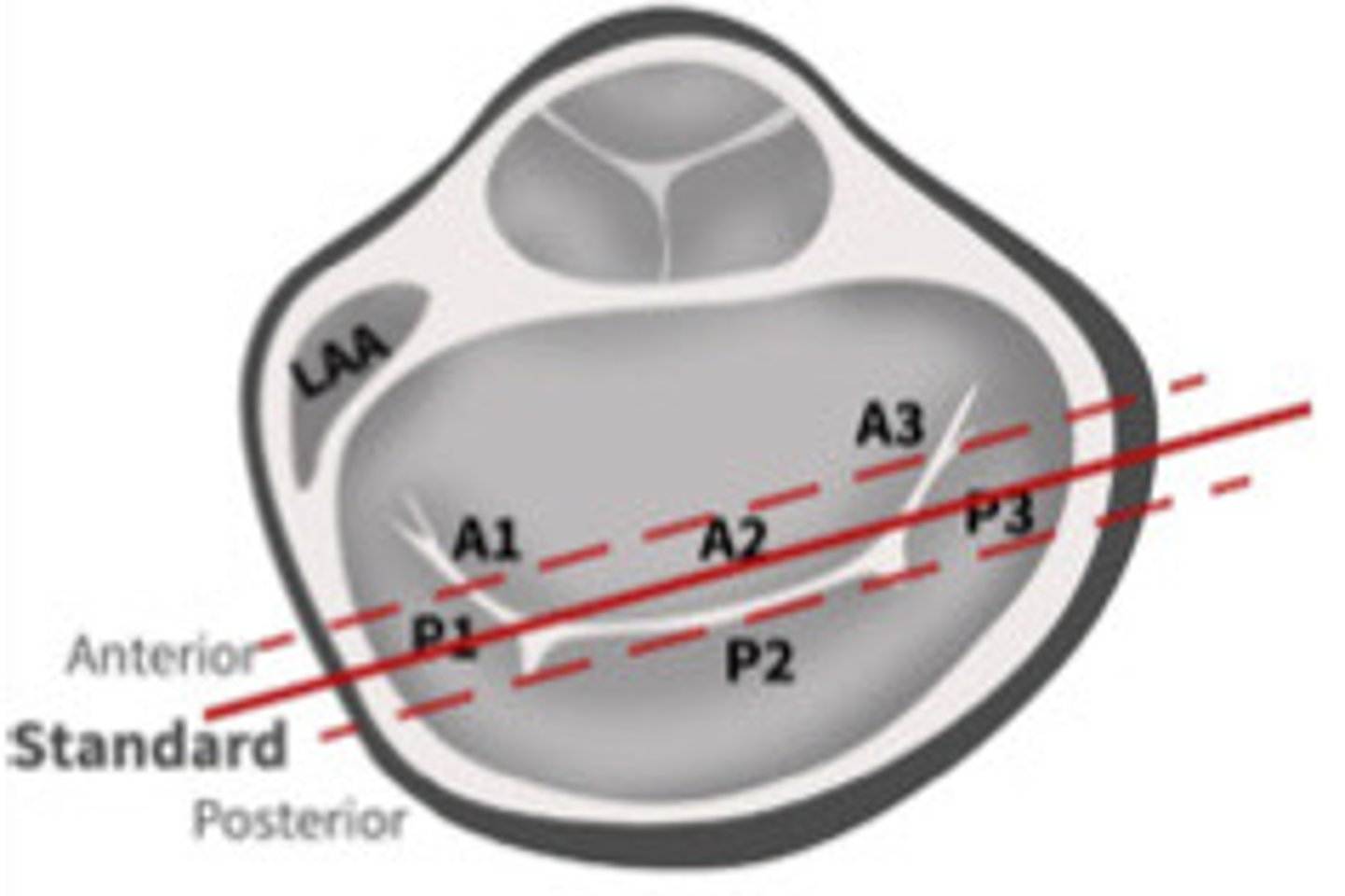 <p>What view is represented by the line</p>