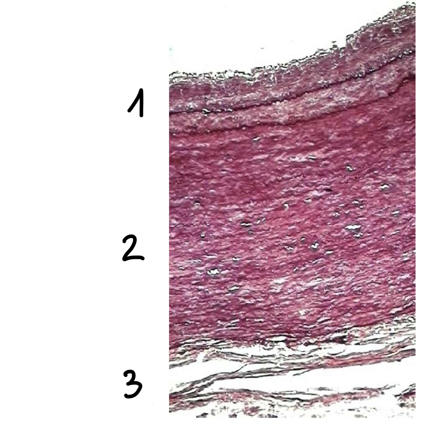 term image