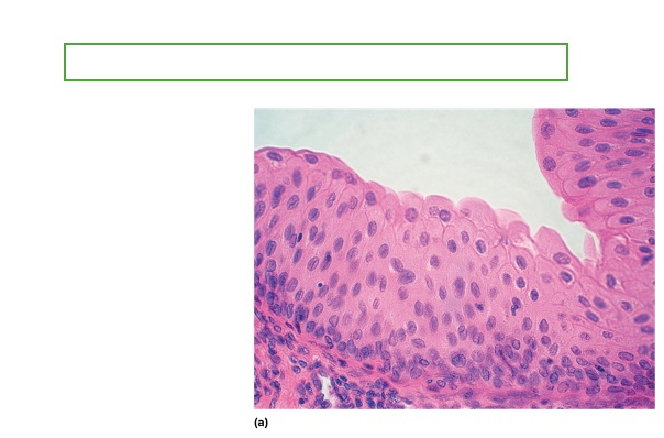 <p>what type is this</p>