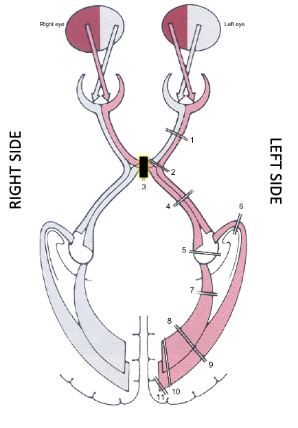 <p>what is it? what does it result in?</p>