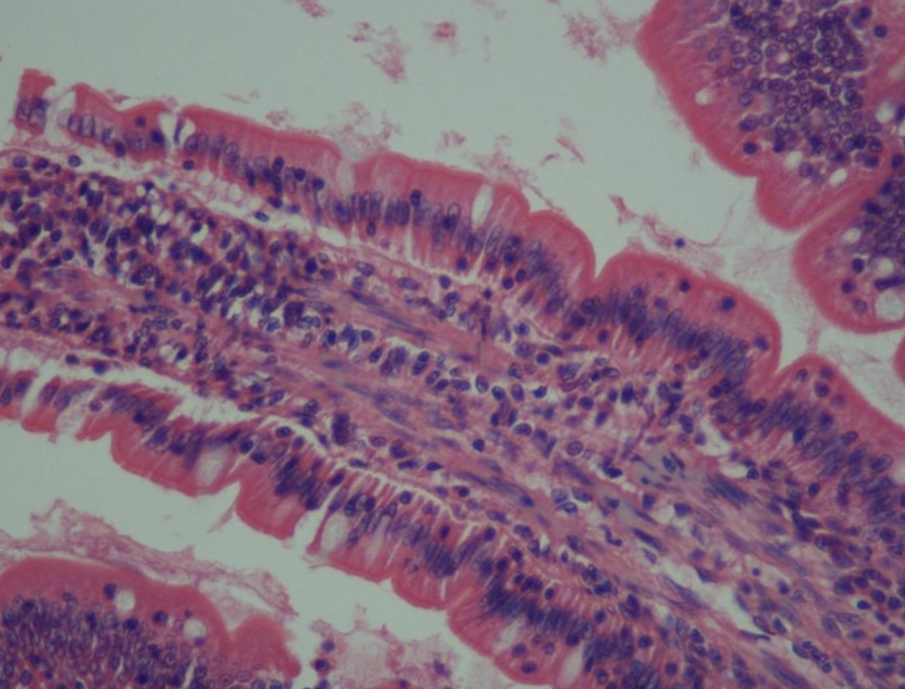 <p>Nucleus at base of tall, narrow cells</p>