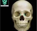 <p>small fragile bone making up part of the front inner walls of each eye socket and providing room for the passage of the lacrimal ducts</p>
