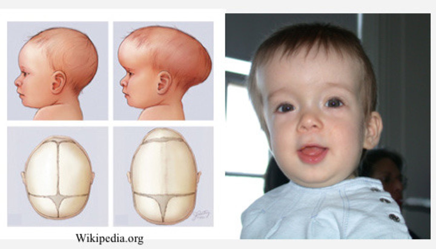 <p>Baby also has cardiac defects</p>