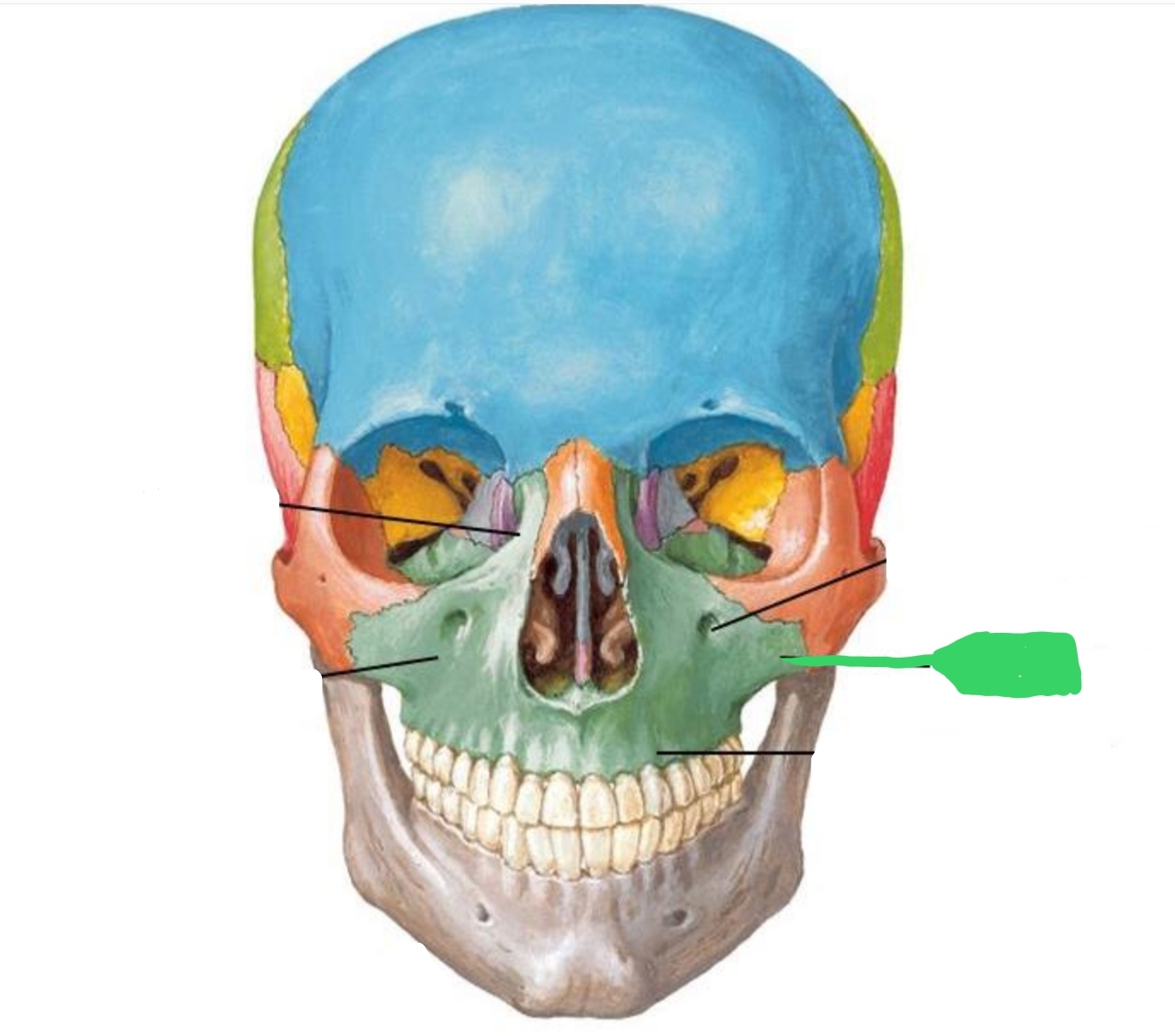 <ul><li><p>forms part of cheek bone</p></li><li><p>Can feel it under the eye</p></li><li><p>Gives shape to cheek</p></li><li><p>Look like a jug handle when viewed from occlusal</p></li></ul><p></p>