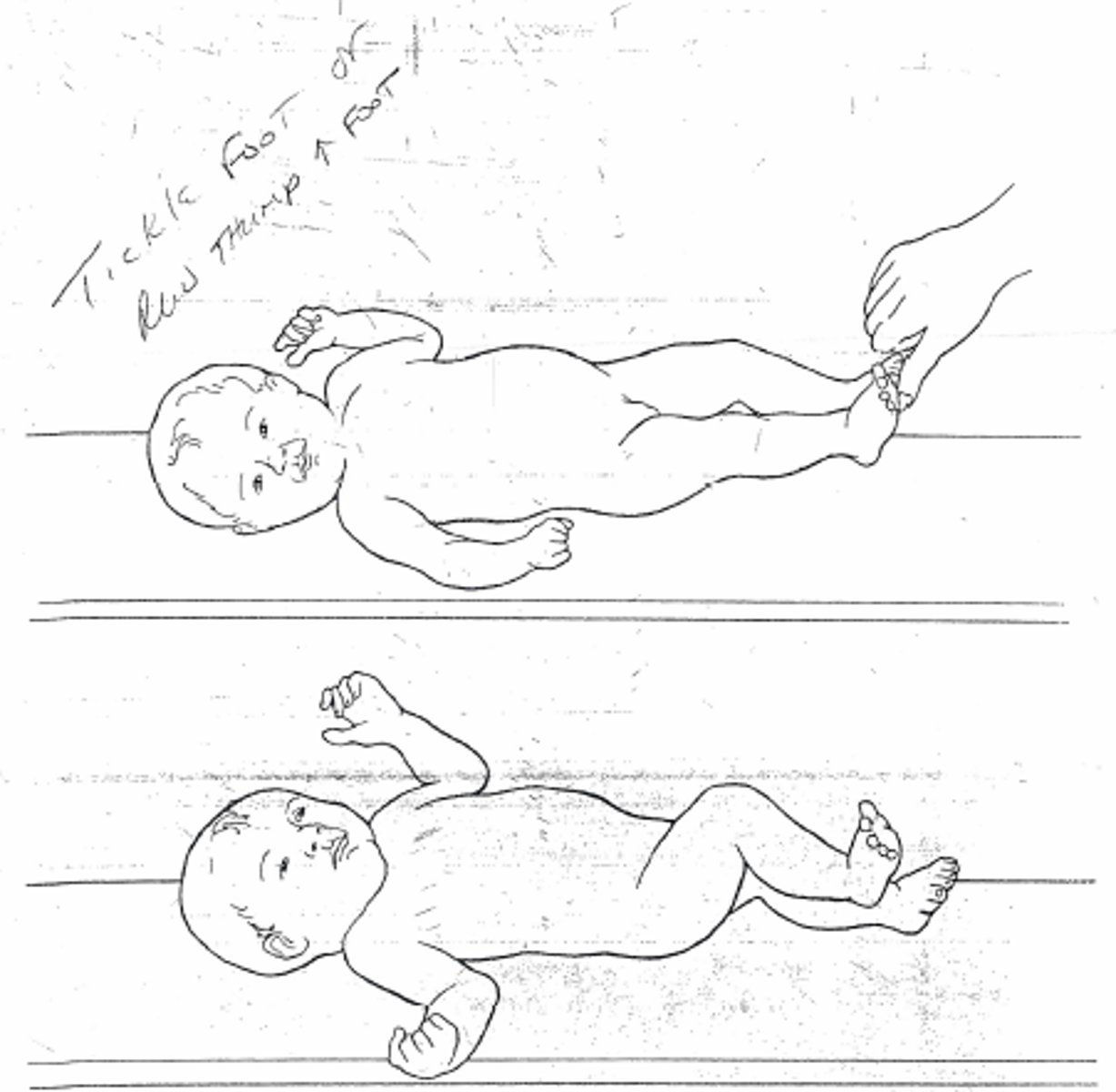 <p>pain to sole of foot, baby will pull LE into flexion to get away</p><p>- develops at 28 weeks gestation</p><p>- integrates 1-2 months</p>
