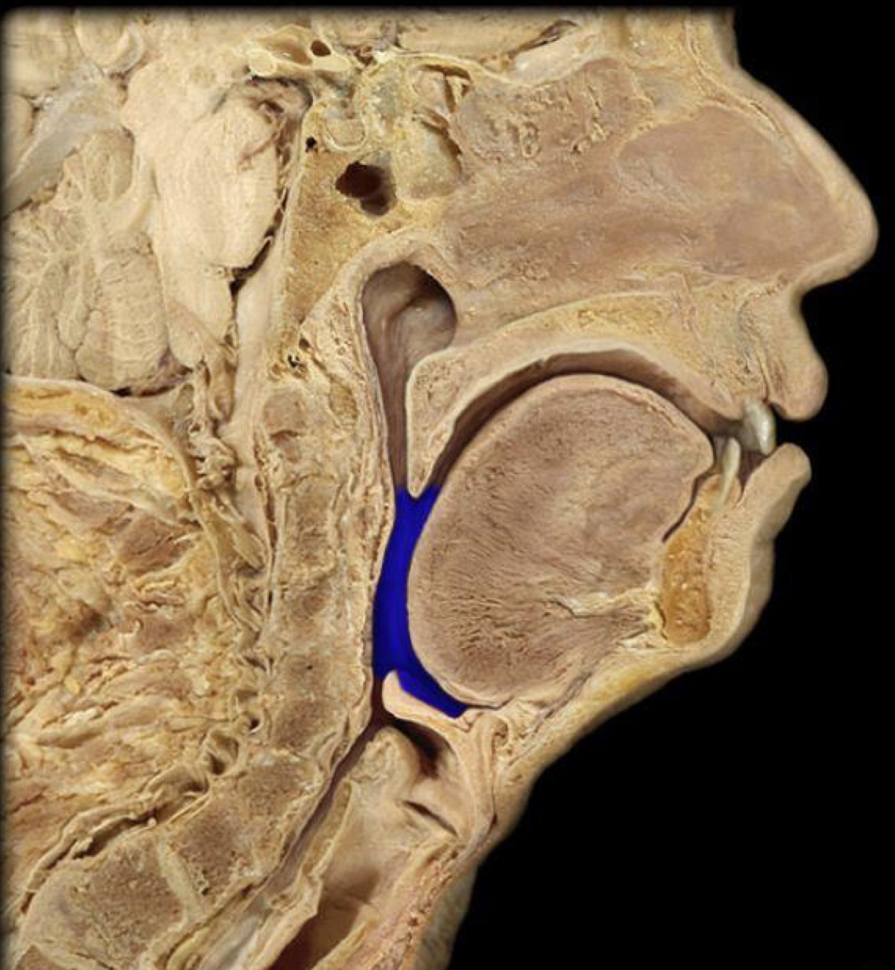 What structure is highlighted in blue?