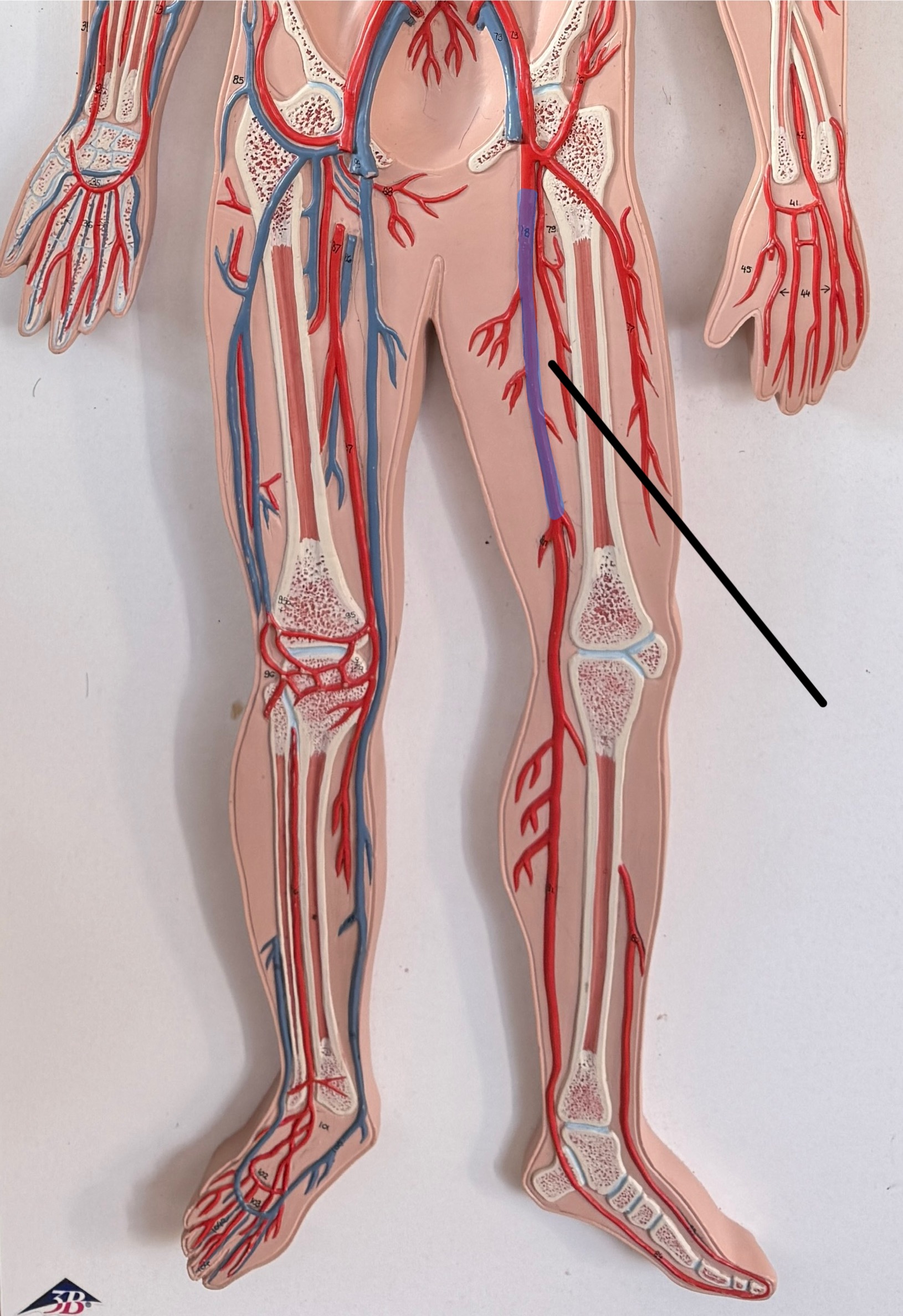 <p>Name this artery.</p>