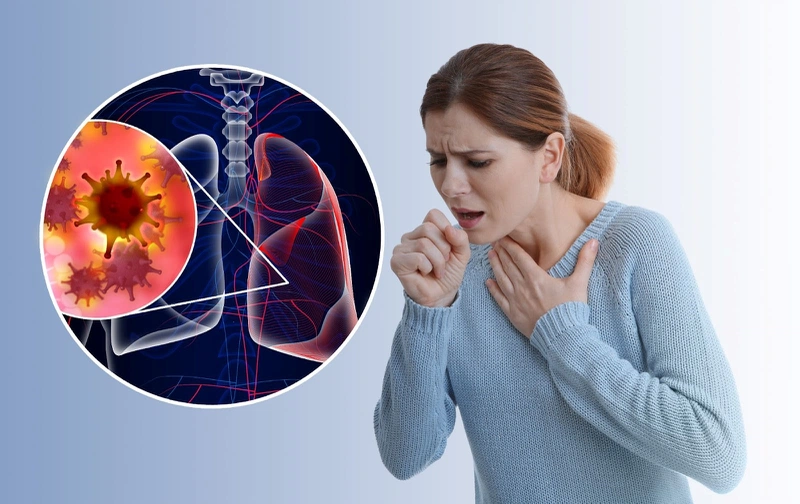 <p>tuberculosis (n)</p>