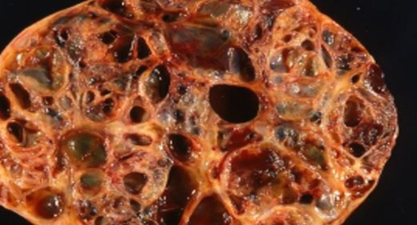 <p>- Most common sex cord-stromal tumour</p><p>- Usually non-malignant tumours in any species</p>