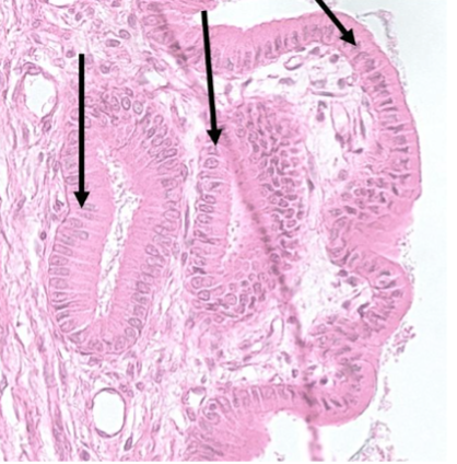<p>What type of tissue is this?</p>