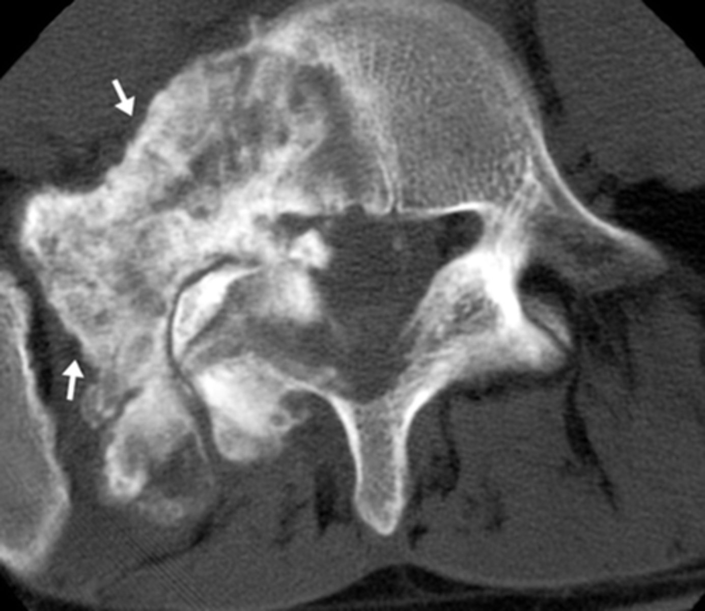 <p>What kind of pathology is this</p>