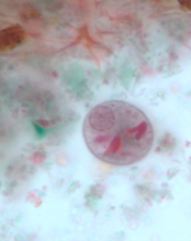 <p>Professor: Dr. Glena Fe A. Yapchulay-Alcabasa</p>