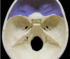 <p>holds the frontal lobe of the brain</p>