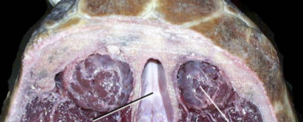 <p>Which one of these lines points to the brain? Which one points to the salt gland?</p>