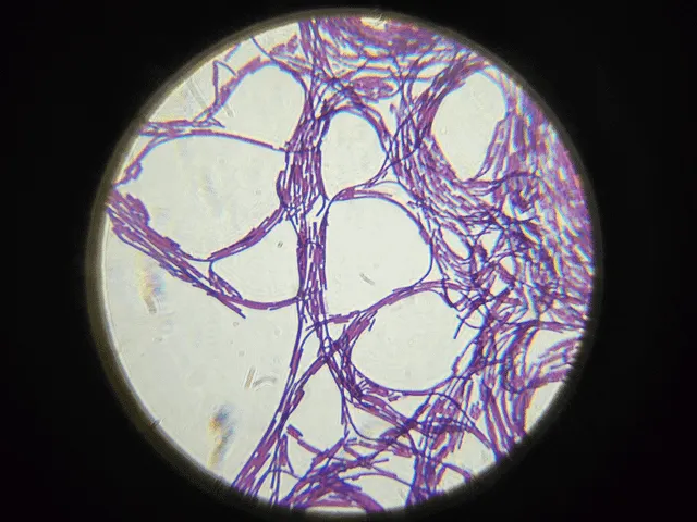 <p>(1) What shape is this bacteria?</p>