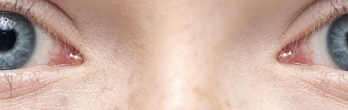 <p>Quel mot désigne le point de jonction entre les os du nez et ceux du front, situé entre les deux yeux ?</p>