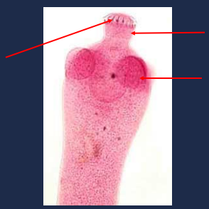 State the name of the lower right portion of the picture.