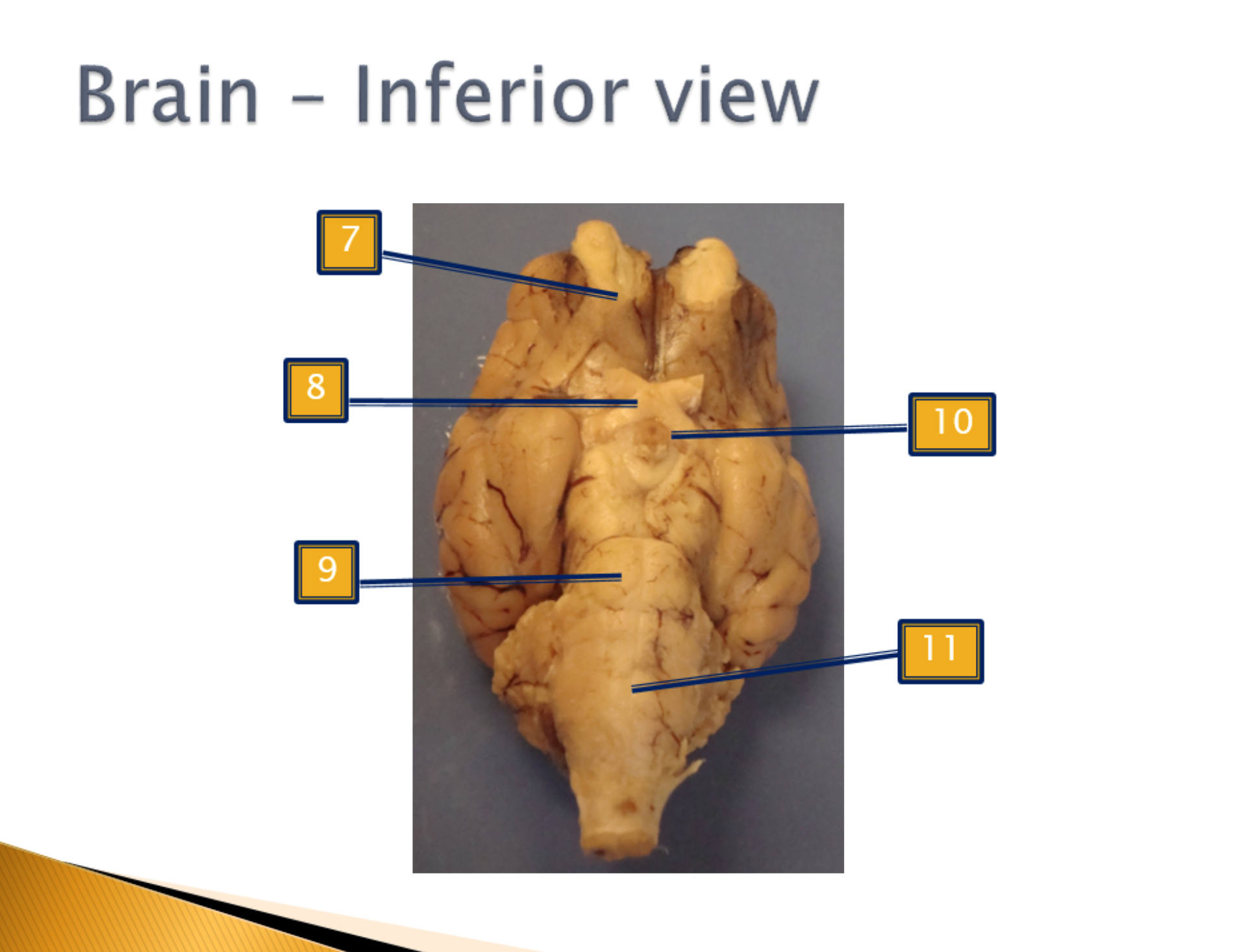 <p>Inferior View</p>