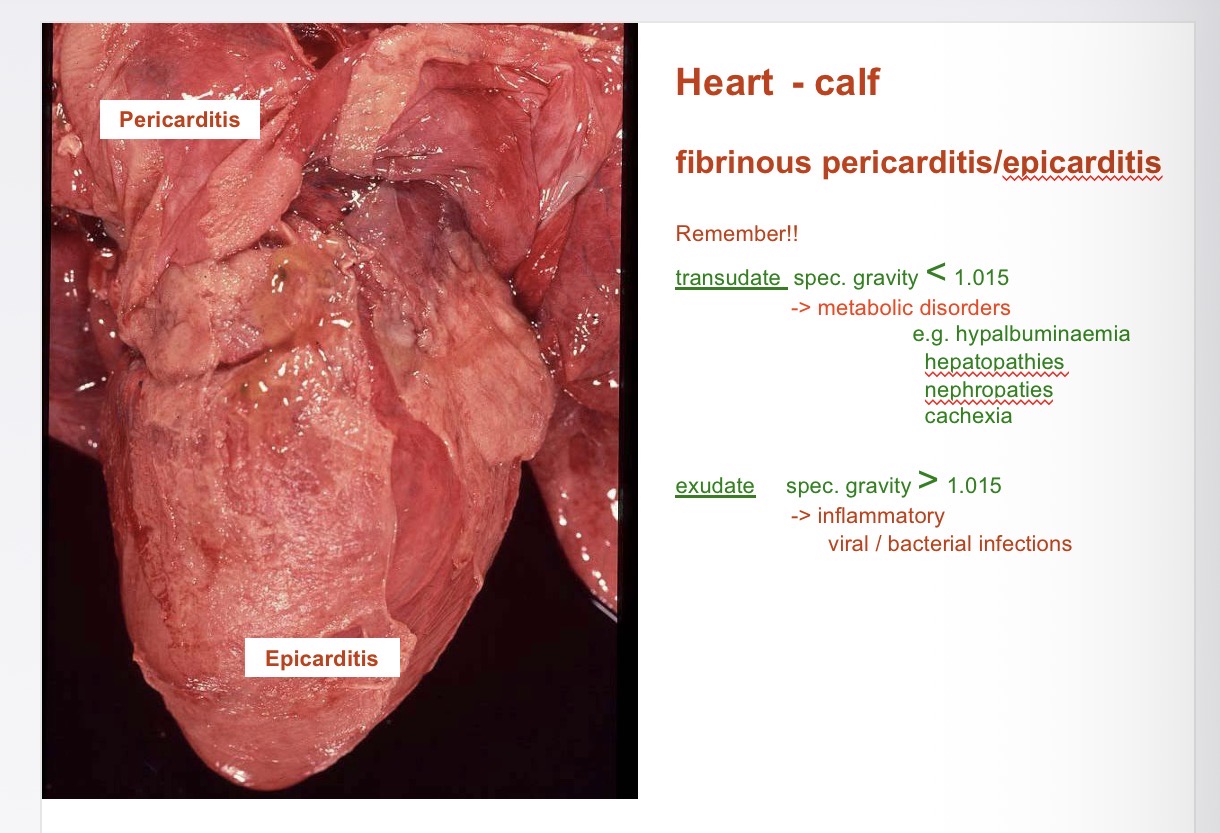 <p>Pericarditis gross</p>