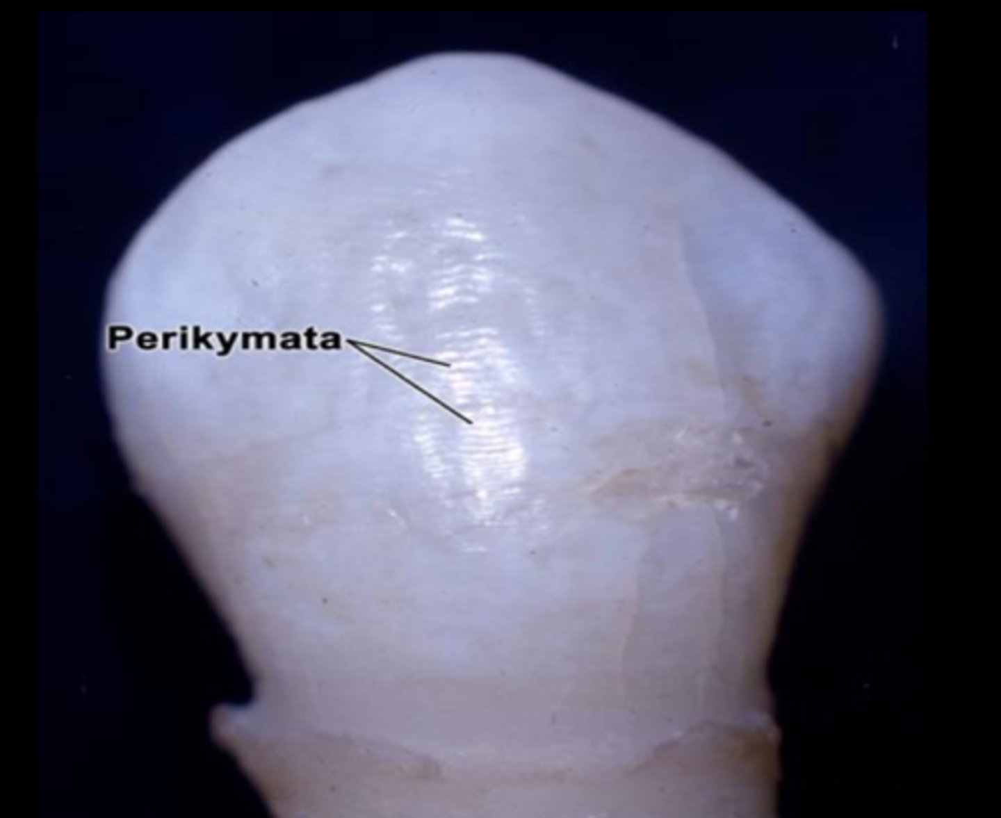 <p>small ridges visible on the labial surface of incisors</p>
