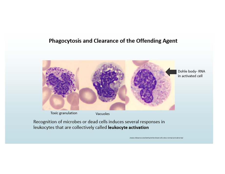 <p>Microbe/dead cell recognition triggers leukocyte response (e.g., Dohl bodies-RNA in activated cell)</p>