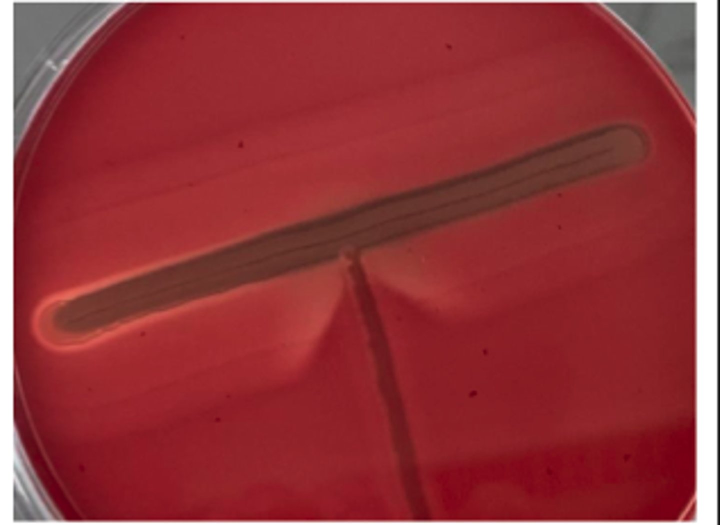 <p>Examine a CAMP reaction.</p><p>Describe the result and what is the likely bacteria ?</p>