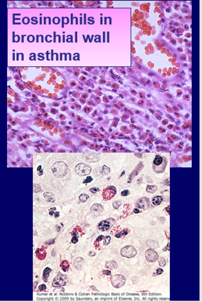 <p>Eosinophils release this, which puts holes in a helminth body, allowing it to then be phagocytosed</p>