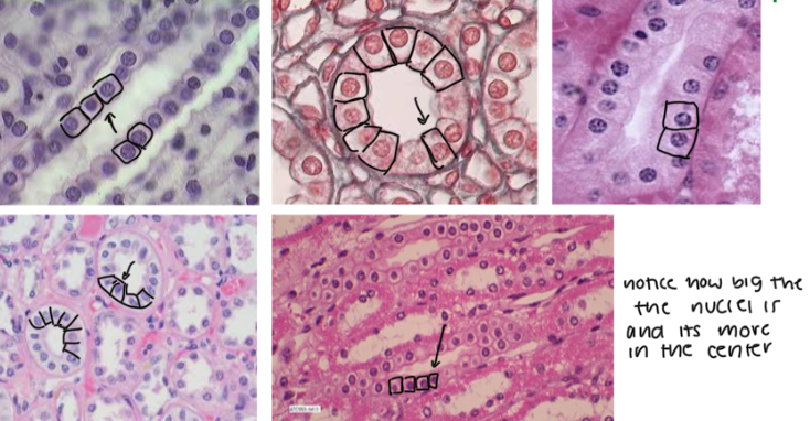<ul><li><p>Characteristic:<strong> CUBE-SHAPED CELLS, NUCLEI is in the CENTER</strong>, and it’s <strong>SINGLE LAYER </strong></p></li><li><p>Location: <strong><em><u>KIDNEYS</u></em></strong></p></li><li><p>Function: <strong>FILTERS BLOOD AND MAKE URINE </strong></p></li></ul><p></p><p>Key thing: these (epithelial cells in general) <strong>LINE the LUMEN (CAVITIES/SPACES)</strong></p><p></p>