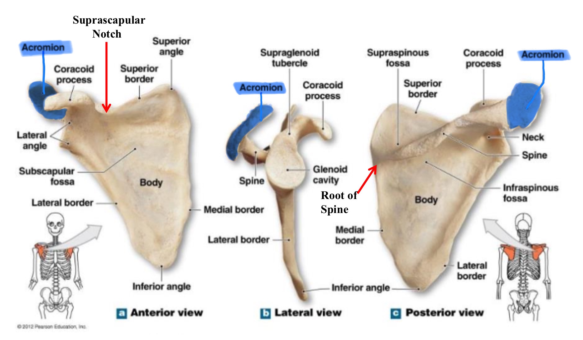 <p>acromion of scapula</p>
