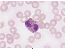 <p></p><p>identify the leukocyte</p>