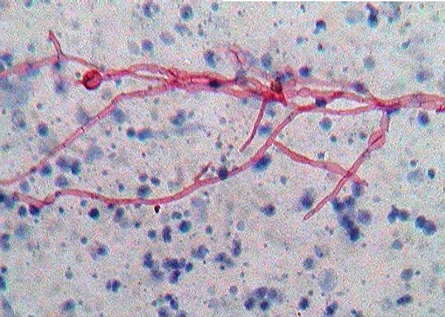 <p>What type of hyphae do aspergillus have? What are some specific species, which is most common?</p>
