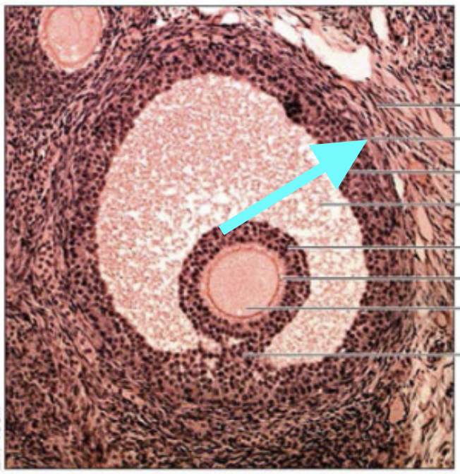 <p>What structure is shown (at arrow)?</p>