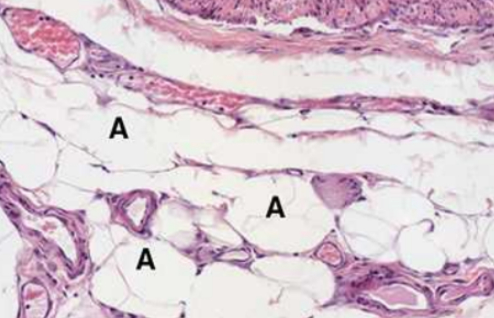 <p>1.  Specimen?<br>2. Describe the specimen.<br>3. Why are fat cells empty?</p>