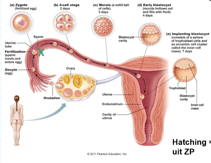 <ul><li><p>transport van de gameten:</p><ul><li><p>spermatozoïden: sommige na 70 min aan het uiteinde van de eileider:</p><ul><li><p>actief + contracties baarmoeder &amp; eileider + chemoattractie</p></li></ul></li><li><p>eicel: passief, peristaltiek eileider → in uterus na 4-5 dagen</p></li><li><p>X (op de foto): plaats van bevruchting</p></li></ul></li><li><p>hatching = vrijkomen uit zona pellucida</p></li></ul><p></p>