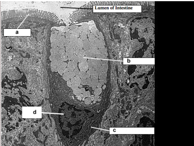 <p>Lumine of Intestine</p>