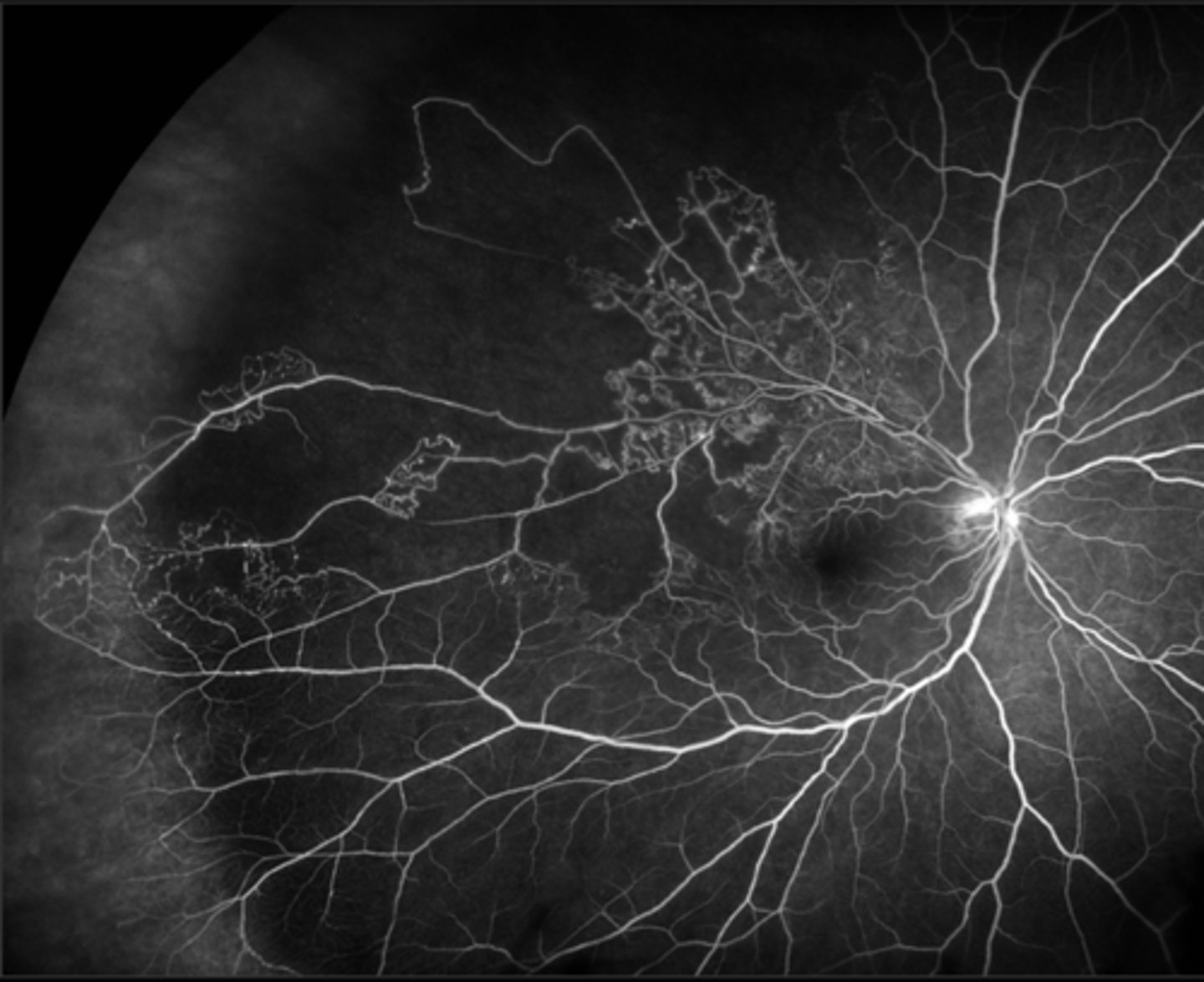 <p>What is the MOA of PRP?</p>