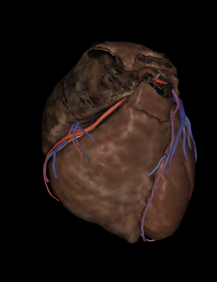 <p>Name the structure highlighted (purple)</p>