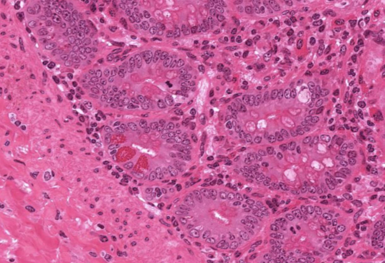 <p>Crypts in Jejunum</p>