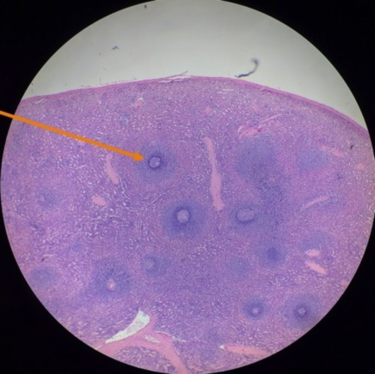 <p>in spleen lymphocyte</p>