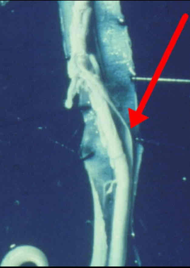 <p>Identify this structure</p>