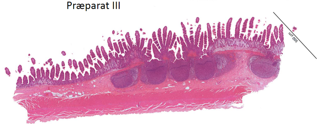 <p><strong>Post 5.</strong></p><p><u>Præparat III</u></p><p></p><p><strong>Spørgsmål 6:</strong> Hvilket specifikt afsnit af tarmen stammer præp III fra?</p>