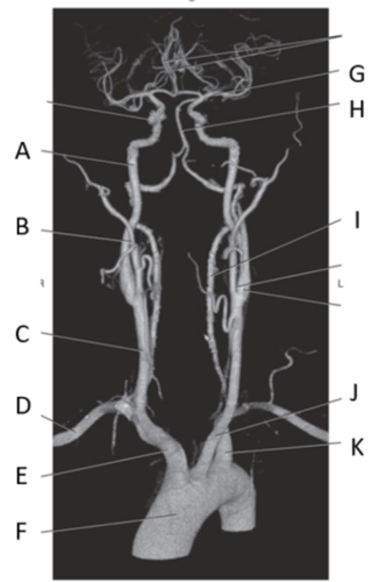 <p>Label K</p>