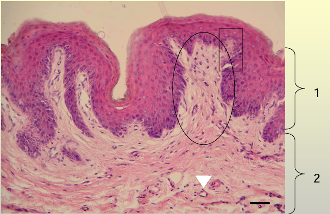 term image
