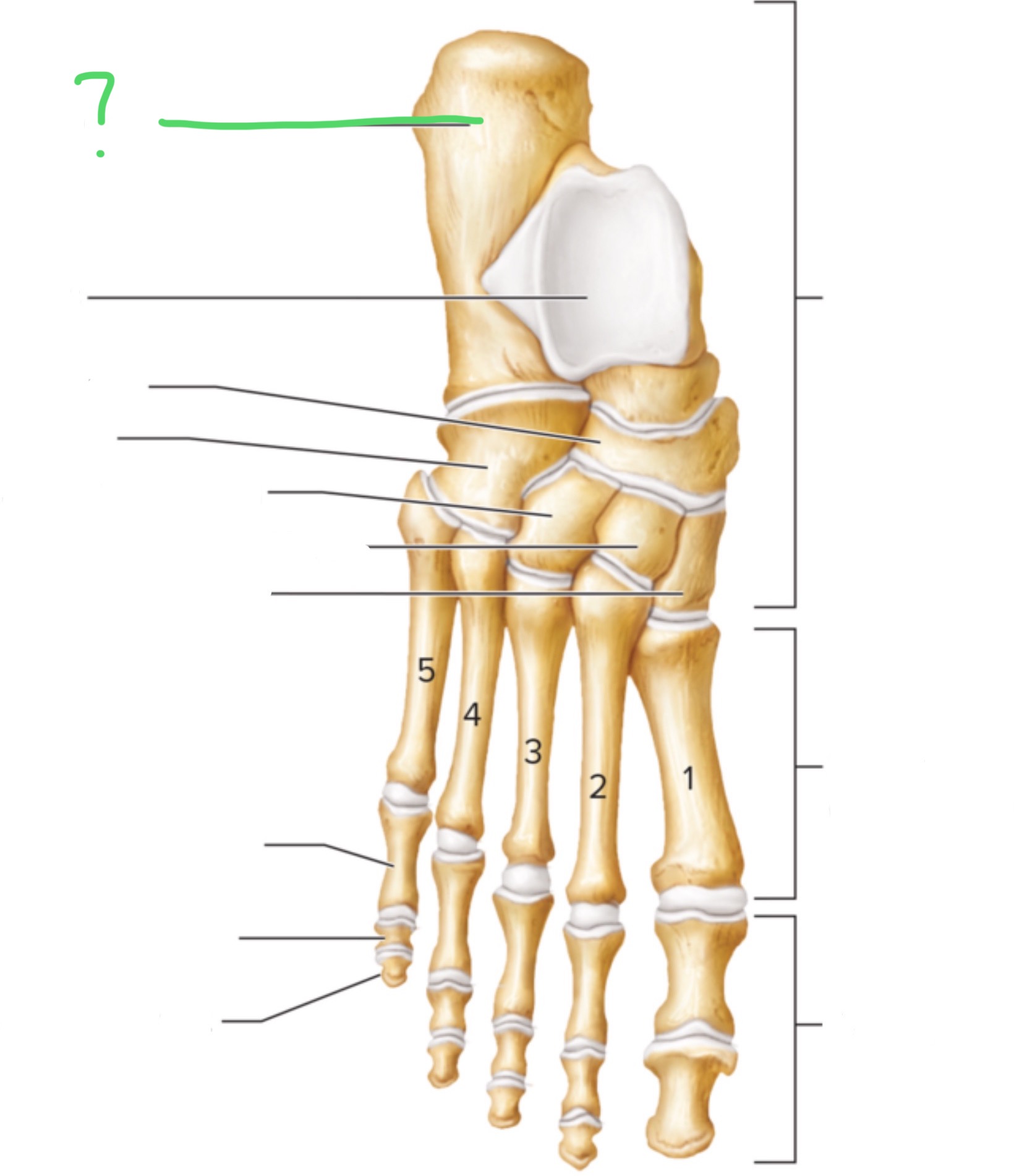 <p>What bone is this?</p>