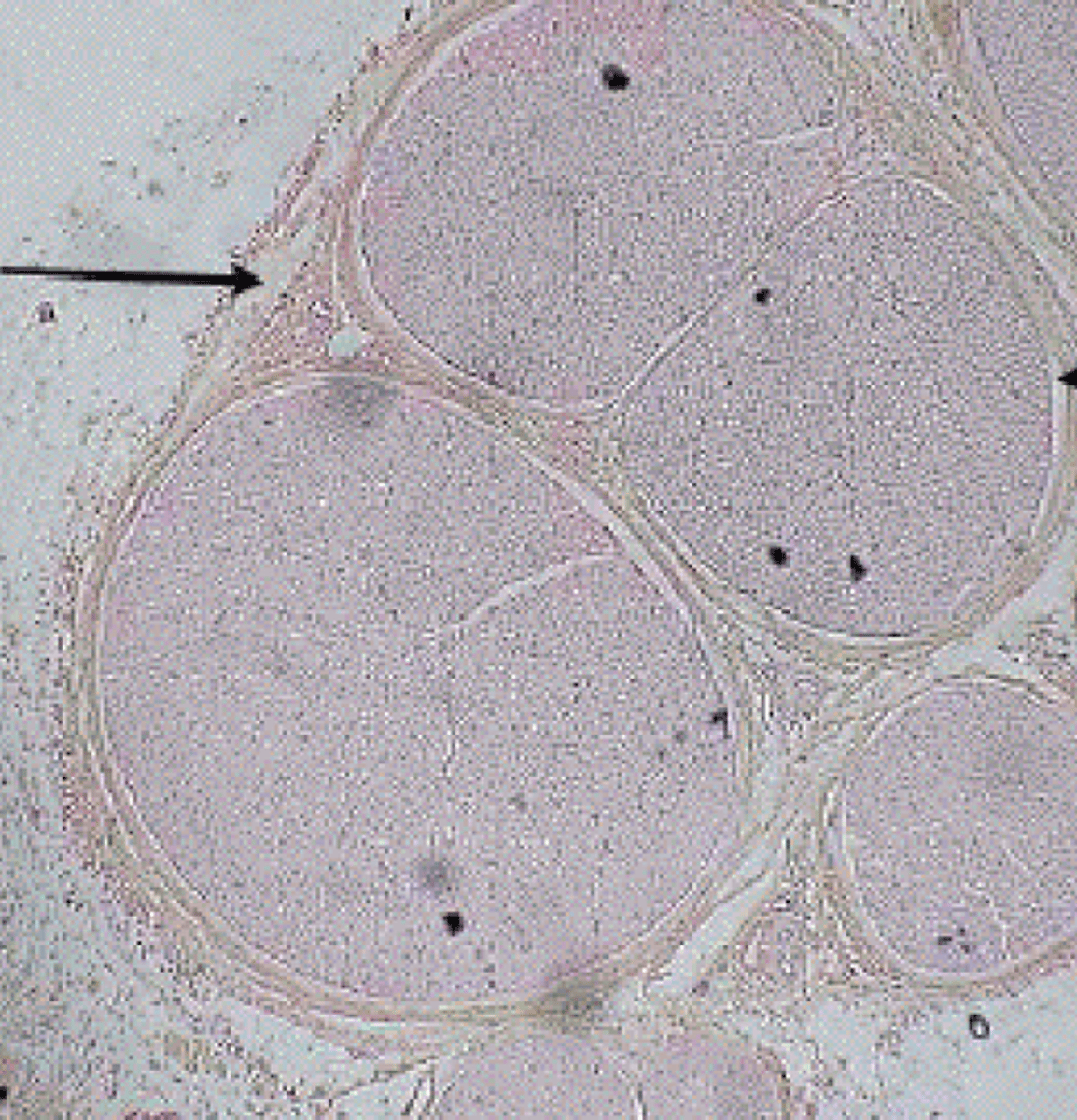 <p>loose connective tissue</p>