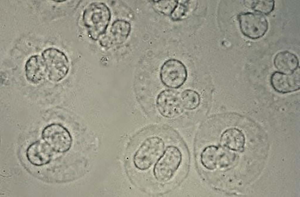 <p>What is in the urine sediment</p>