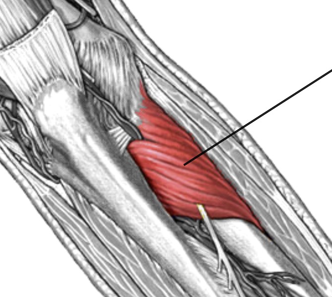<p>Which muscle of the forearm is:</p><ul><li><p>Located on posterior radius, deep to anconeus</p></li><li><p>Action: supinates forearm</p></li><li><p>Nerve: radial</p></li></ul><p></p>