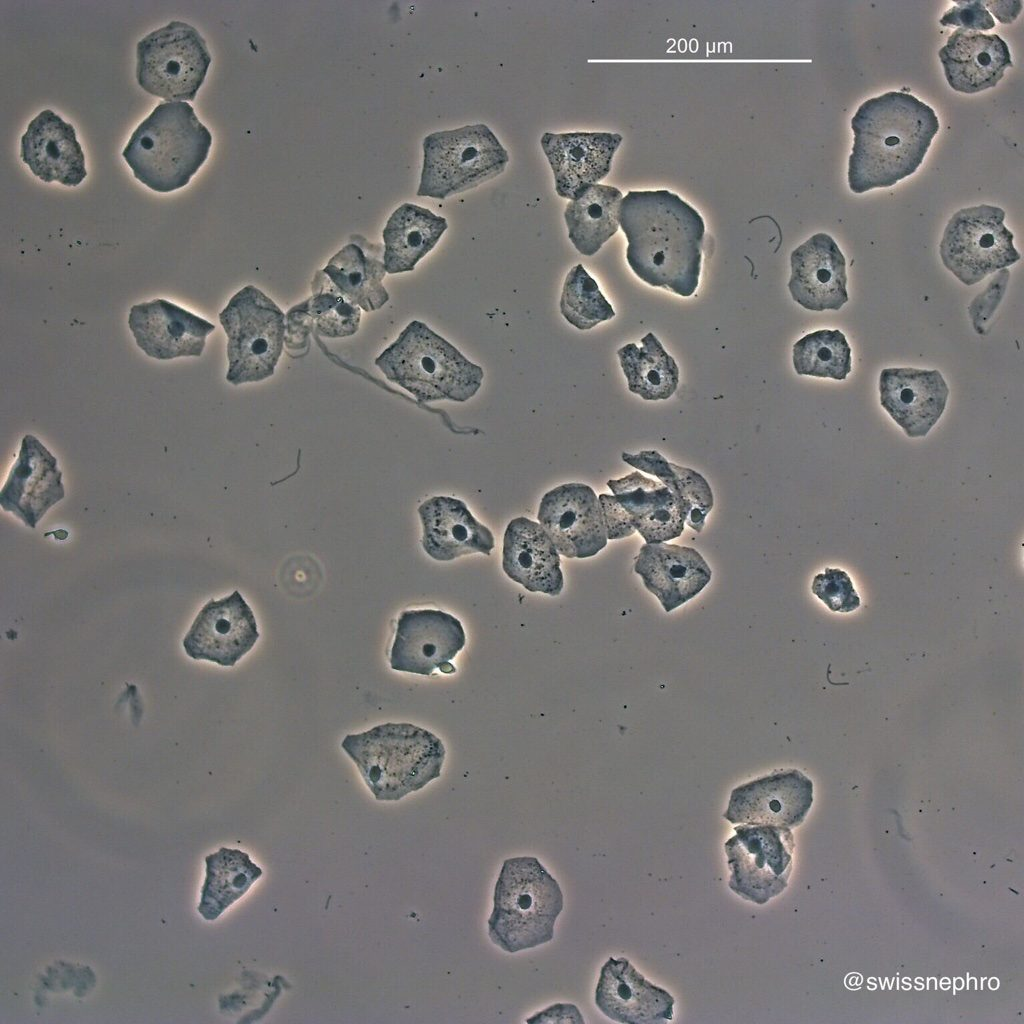 <p>large, flat</p>